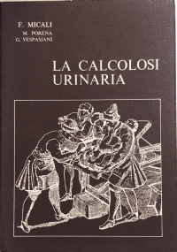 La calcolosi urinaria