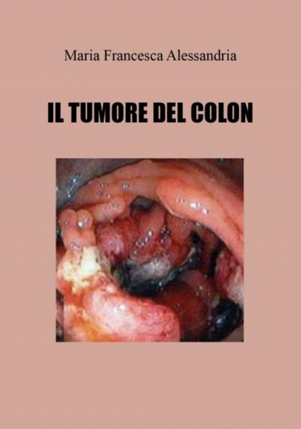 Il tumore del colon di Maria Francesca Alessandria