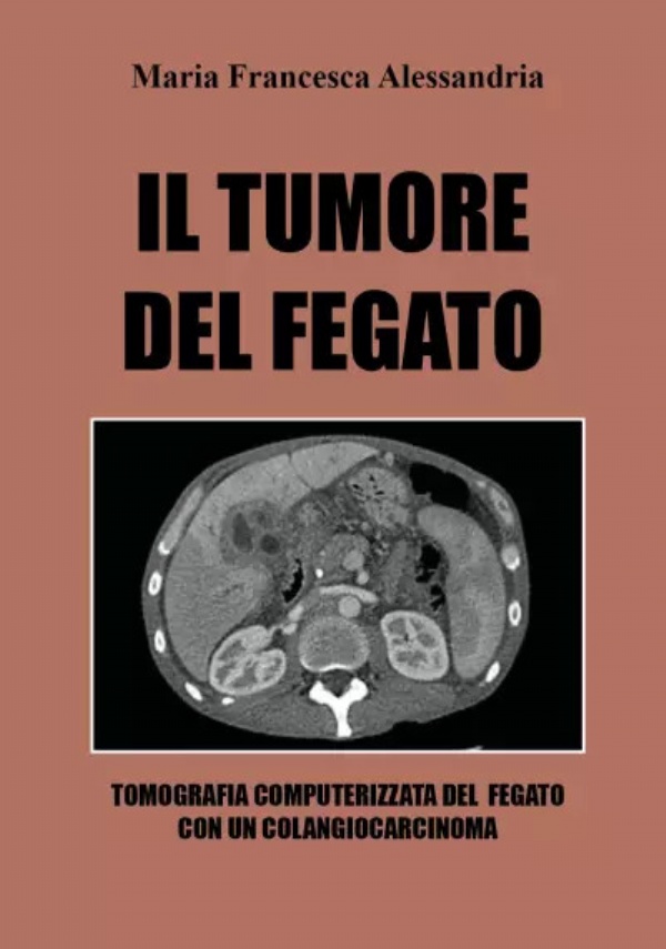 Il tumore del fegato di Maria Francesca Alessandria