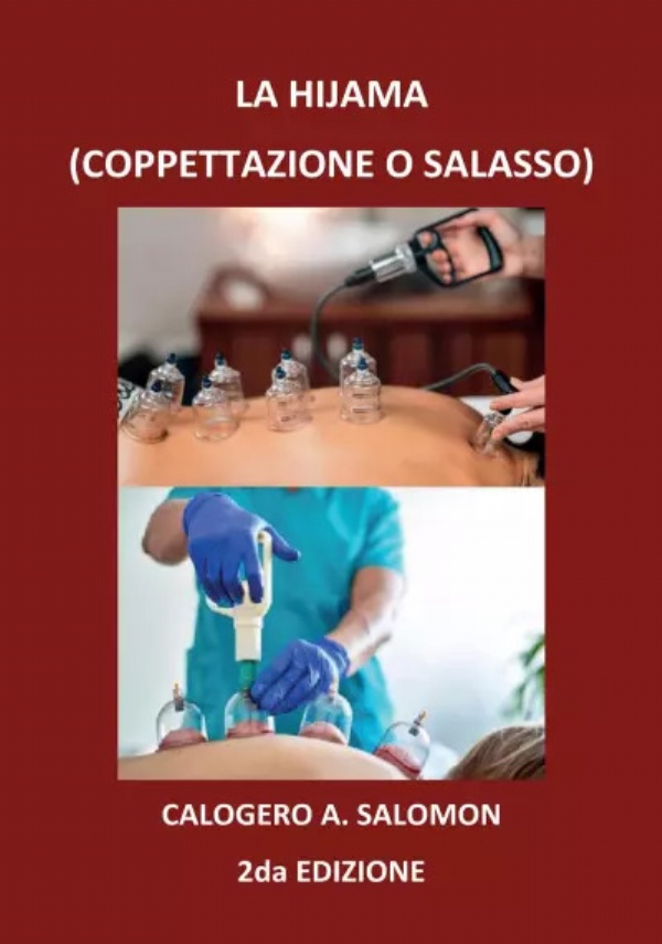 La Hijama 2da. Edizione di Calogero A. Salomon