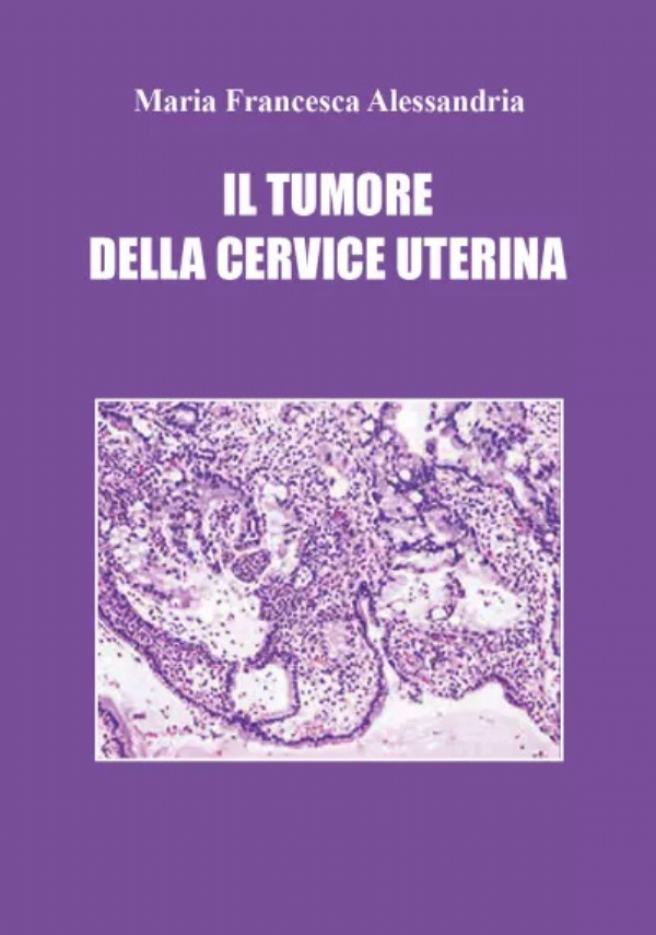 Il tumore della cervice uterina di Maria Francesca Alessandria